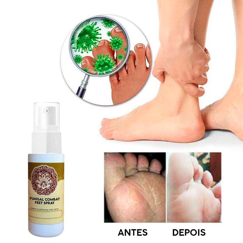 Spray de Tratamento Esterilizante para Pés- Fungal